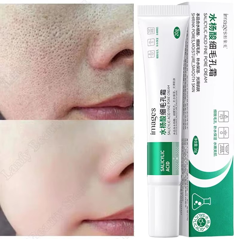 Creme de Ácido Salicílico para - Salicylic Acid Blackhead Remover avaliação e preço